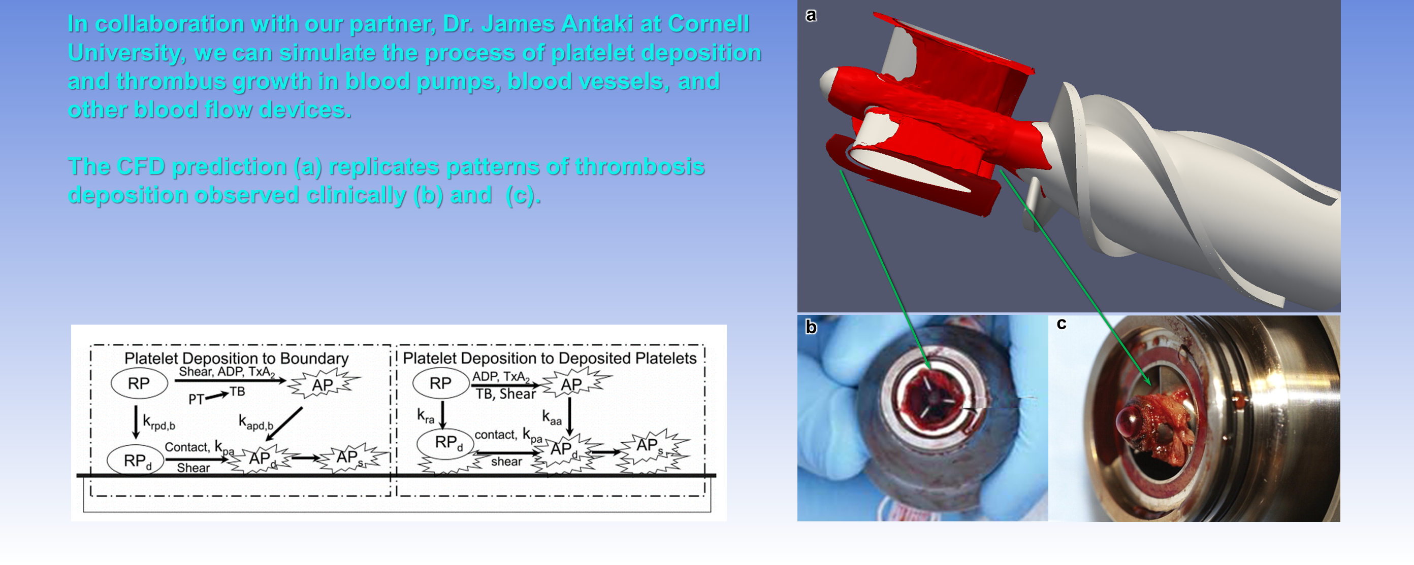 THROMBOSIS CFD